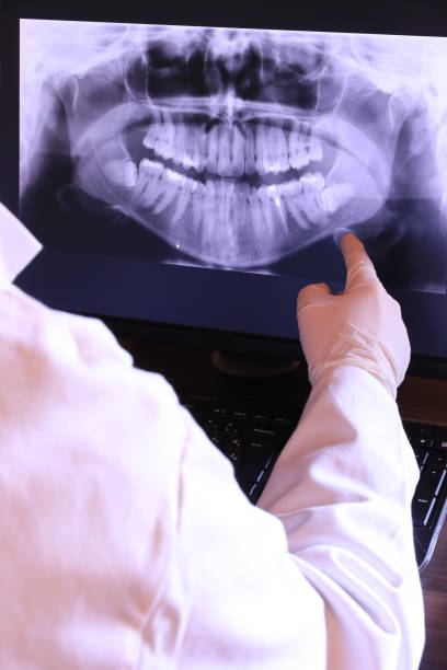 Emergency Dental Filling Replacement in CT